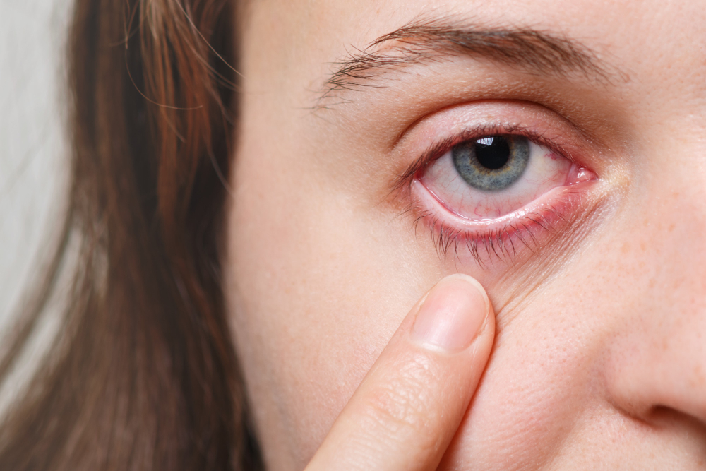 Recognising the Signs of Eye Infections and Knowing When to Consult an Eye Doctor